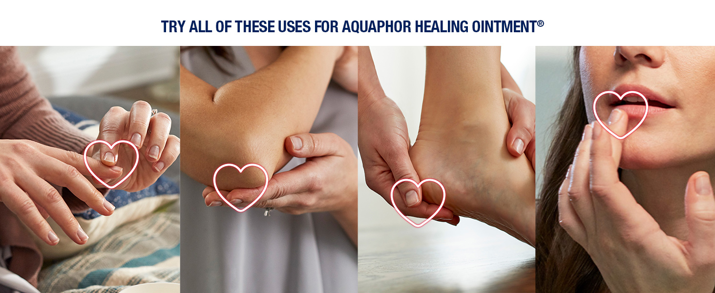 aquaphor healing ointment, multipurpose solution, dry skin, cracked lips, chapped lips