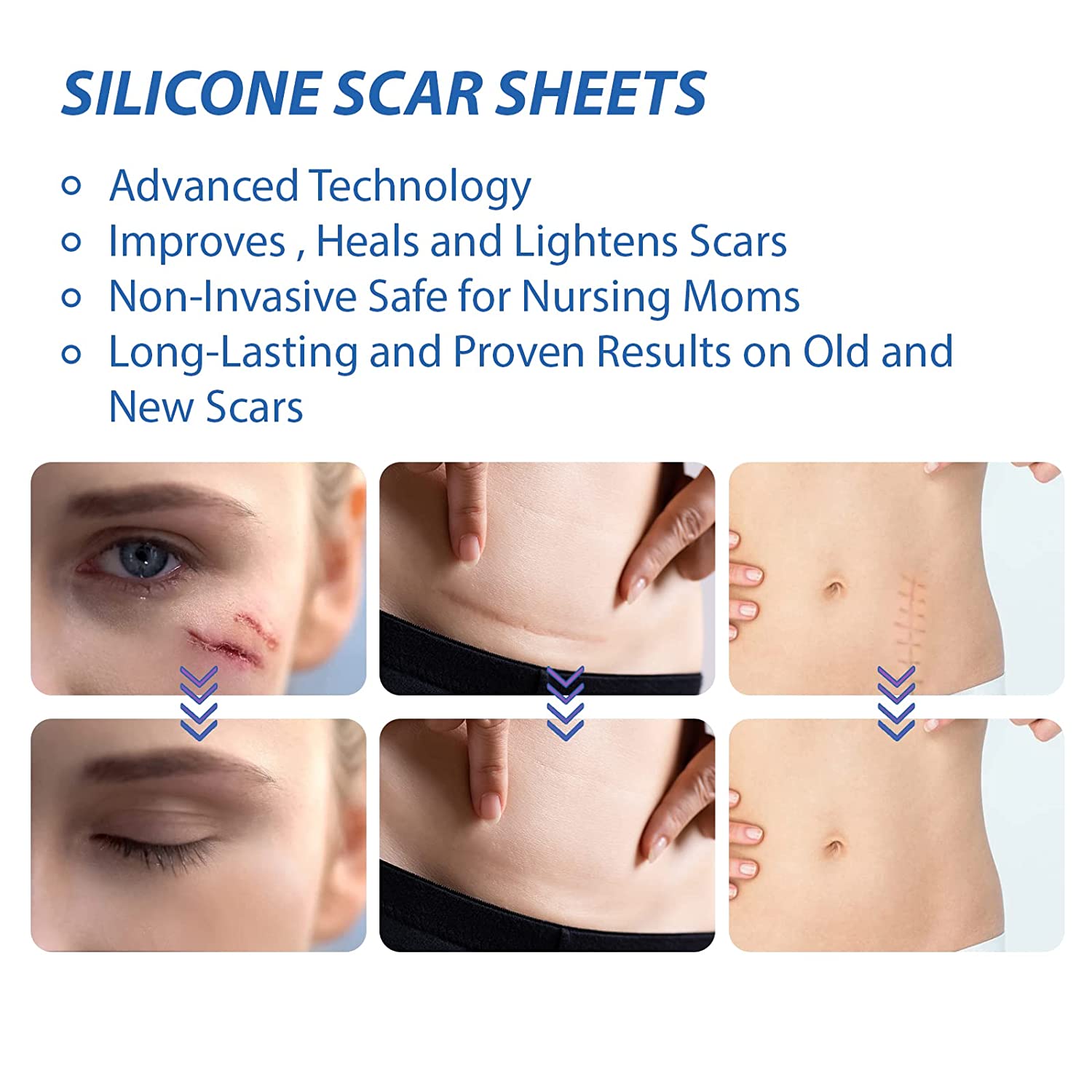 ScarAway Silicone Scar Sheets - Medrock Pharmacy