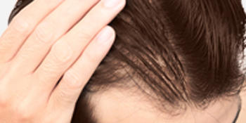 Nioxin Thickening Spray hair loss